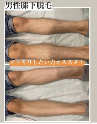 Shop images Male waxing sugaring hair removal today's booking available in Sapporo 